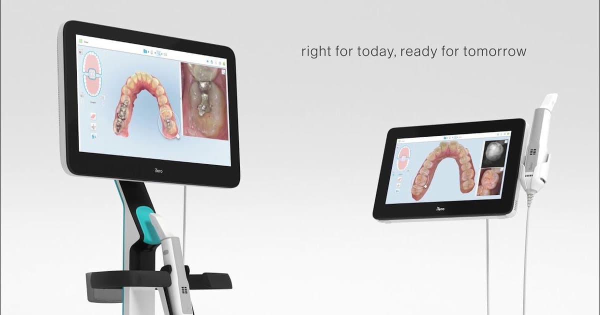 Goodbye to Messy Impressions!: The Benefits of Digital Crown Impressions and Premium Materials