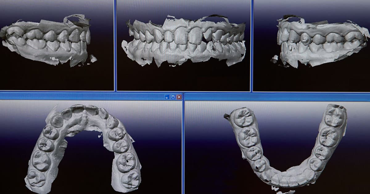 Revolutionizing Oral Health: Understanding the Role of Advanced Dental Technologies